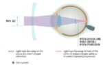 Rocky Myopia Control 360 Độ